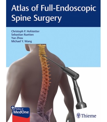 Atlas of Full-Endoscopic Spine Surgery