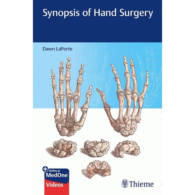Synopsis of Hand Surgery