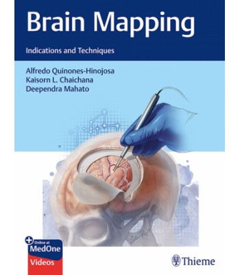 Brain Mapping - Indications and Techniques 