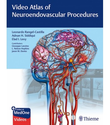 Video Atlas of Neuroendovascular Procedures