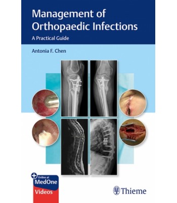 Management of Orthopaedic Infections: A Practical Guide 