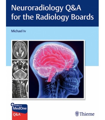 Neuroradiology Q&A for the Radiology Boards 