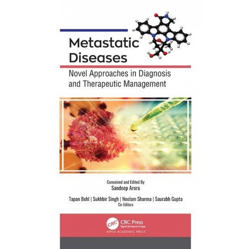 Metastatic Diseases Novel Approaches in Diagnosis and Therapeutic Management