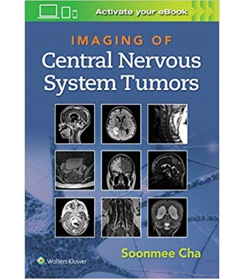 Imaging of Central Nervous System Tumors First edition