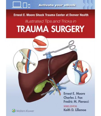 Ernest E. Moore Shock Trauma Center at Denver Health Illustrated Tips and Tricks in Trauma Surgery, 1st Edition