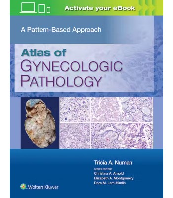 Atlas of Gynecologic: Pathology A Pattern-Based Approach, 1st Edition