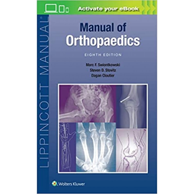 Manual of Orthopaedics 8Ε, Lippincott Manual Series 