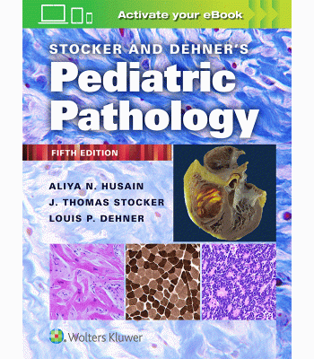 Stocker and Dehner’s Pediatric Pathology, 5E