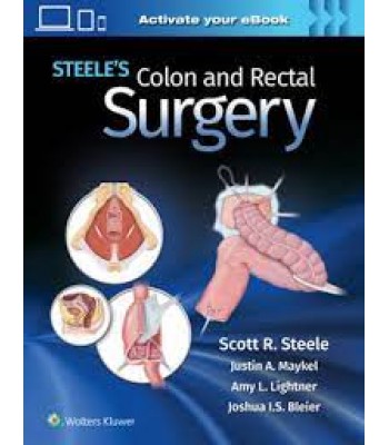 Steele's Colon and Rectal Surgery 1E