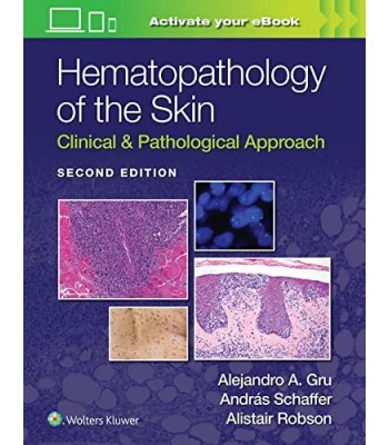 Hematopathology of the Skin Clinical & Pathological Approach, 2E 