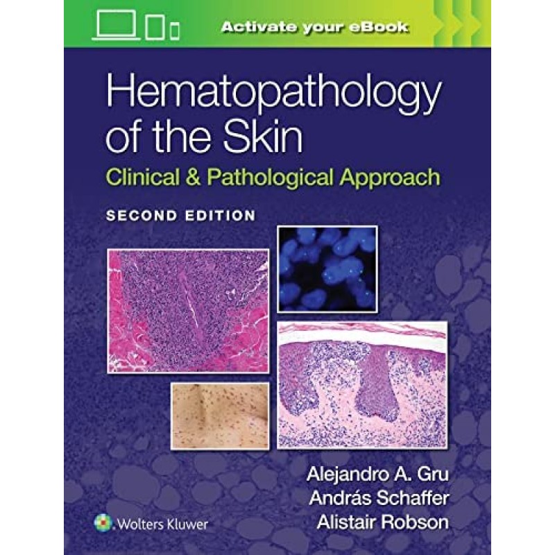 Hematopathology of the Skin Clinical & Pathological Approach, 2E 