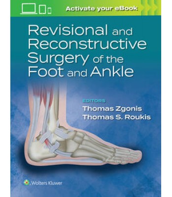 Revisional and Reconstructive Surgery of the Foot and Ankle First edition