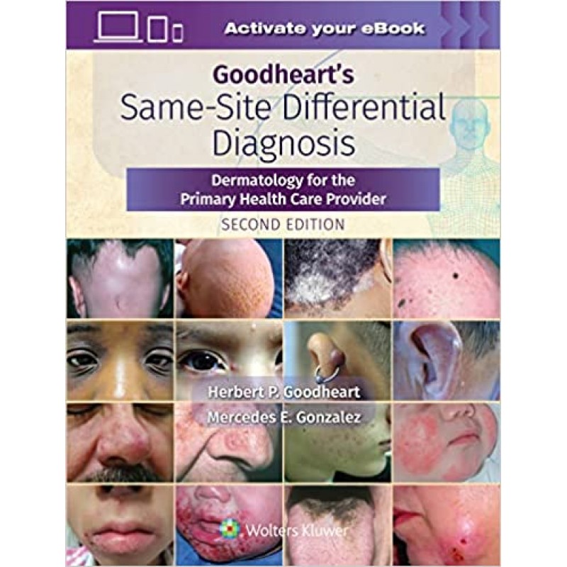 Goodheart’s Same-Site Differential Diagnosis: Dermatology for the Primary Health Care Provider, 2E