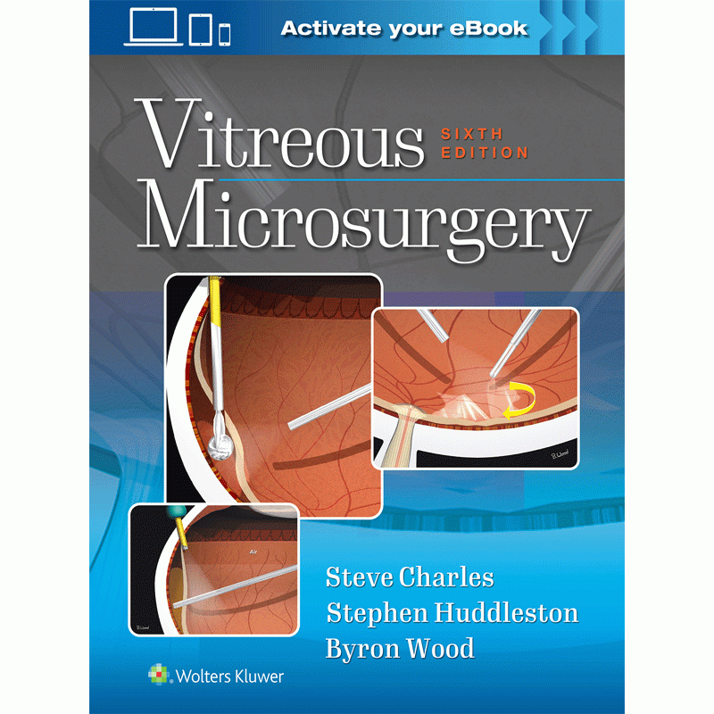 Vitreous Microsurgery, 6E