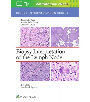 Biopsy Interpretation of the Lymph Node, 1st Εdition, Biopsy Interpretation Series