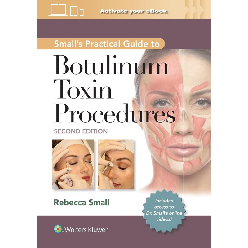 Small's Practical Guide to Botulinum Toxin Procedures, 2nd Edition