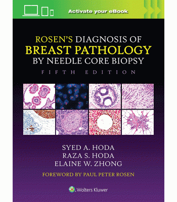 Rosen’s Diagnosis of Breast Pathology by Needle Core Biopsy, 5th Edition