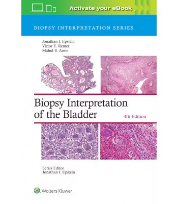 Biopsy Interpretation of the Bladder, 4th Edition, Biopsy Interpretation Series