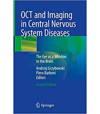 OCT and Imaging in Central Nervous System Diseases