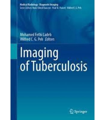 Imaging of Tuberculosis 