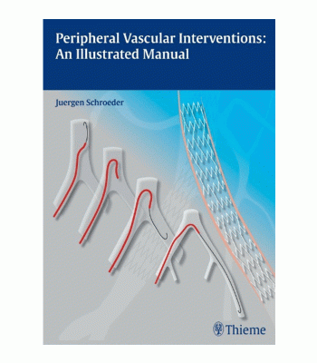 Peripheral Vascular Interventions: An Illustrated Manual