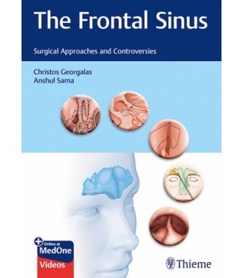 The Frontal Sinus: Surgical Approaches and Controversies 