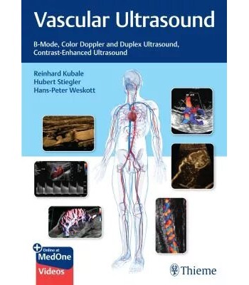Vascular Color Duplex Ultrasound (ΥΠΟ ΕΚΔΟΣΗ ΙΟΥΛΙΟΣ 2023)