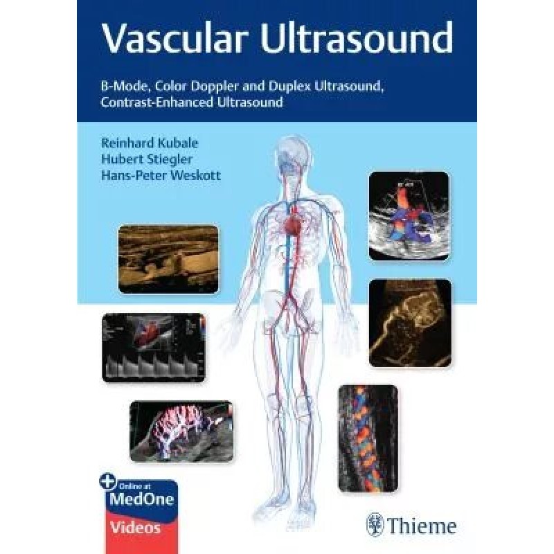  Vascular Ultrasound B-Mode, Color Doppler and Duplex Ultrasound, Contrast-Enhanced Ultrasound