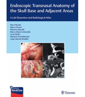 Endoscopic Transnasal Anatomy of the Skull Base and Adjacent Areas - A Lab Dissection and Radiological Atlas 