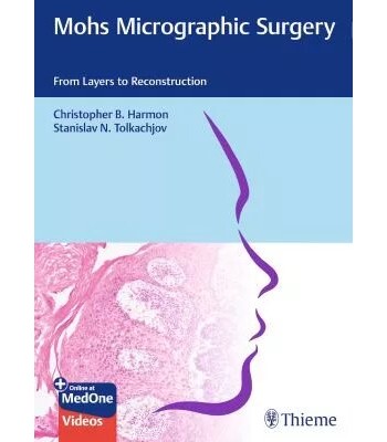  Mohs Micrographic Surgery From Layers to Reconstruction 