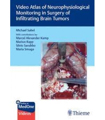 Video Atlas of Neurophysiological Monitoring in Surgery of Infiltrating Brain Tumors