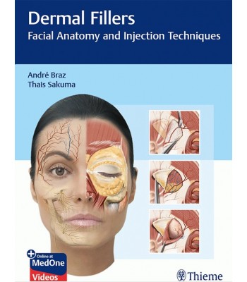 Dermal Fillers: Facial Anatomy and Injection Techniques 