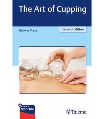 The Art of Cupping 2nd Edition