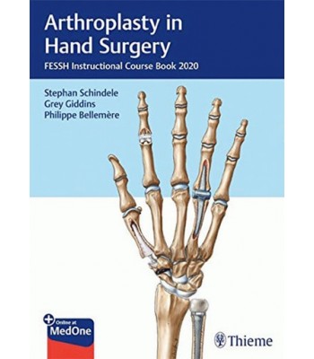 Arthroplasty in Hand Surgery FESSH Instructional Course Book 2020 