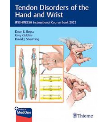 Tendon Disorders of the Hand and Wrist