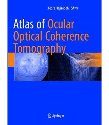 Atlas of Ocular Optical Coherence Tomography