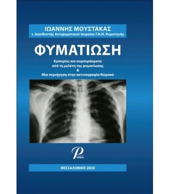 Φυματίωση: Εμπειρίες και Συμπεράσματα από τη Μελέτη της Φυματίωσης και μία Περιήγηση στην Ακτινογραφία Θώρακα