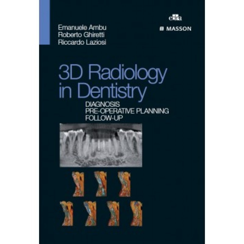 3D radiology in dentistry. Diagnosis pre-operative planning follow-up