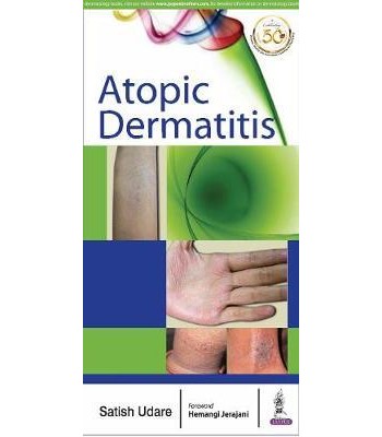  Atopic Dermatitis