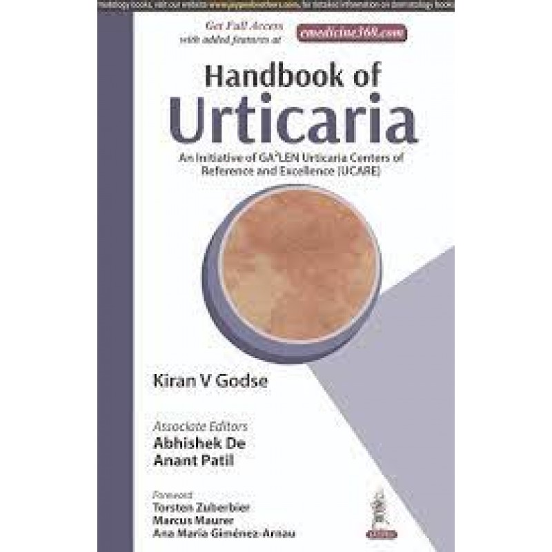  Handbook of Urticaria: An Initiative of GA2LEN Urticaria Centers of Reference and Excellence (UCARE)