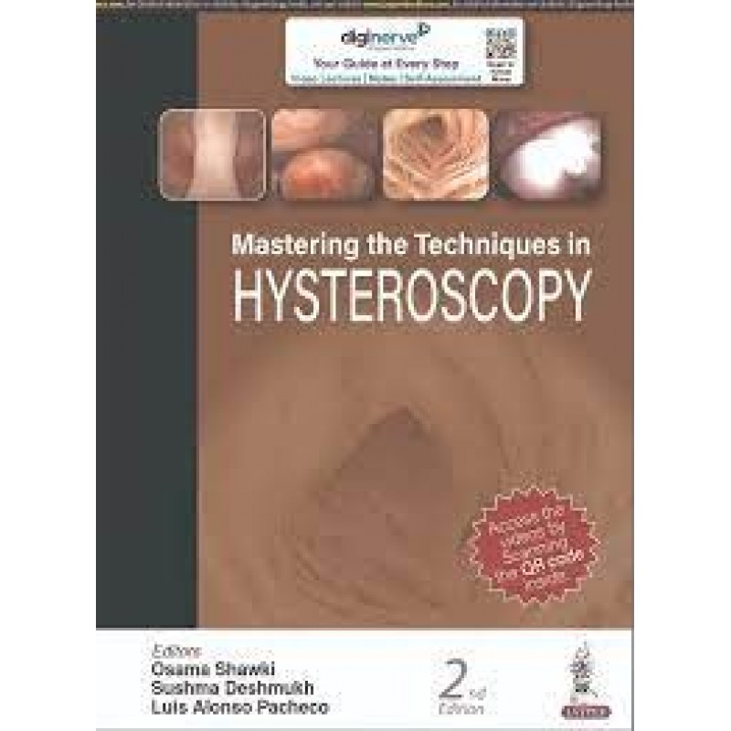Mastering the Techniques in Hysteroscopy