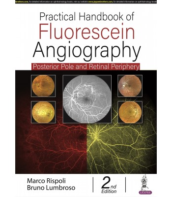 Practical Handbook of Fluorescein Angiography: Posterior Pole and Retinal Periphery