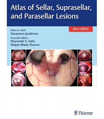 Atlas of Sellar, Suprasellar, and Parasellar Lesions