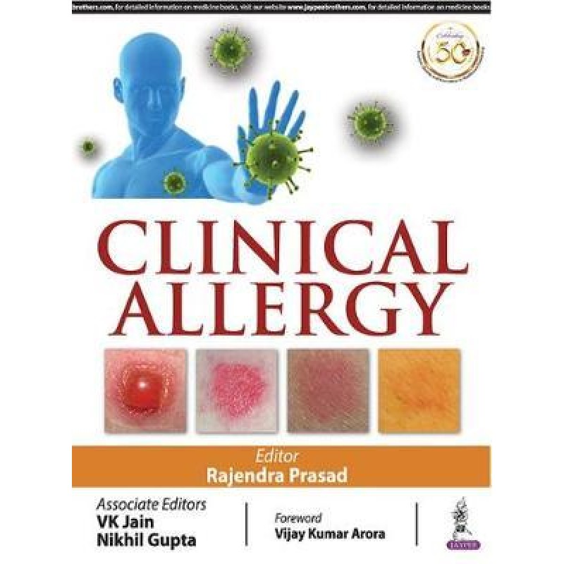  Clinical Allergy