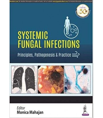 Systemic Fungal Infections: Principles, Pathogenesis & Practice