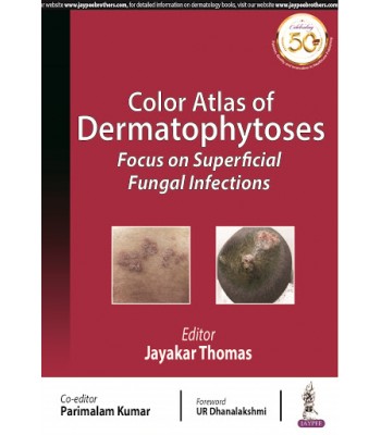 Color Atlas of Dermatophytoses