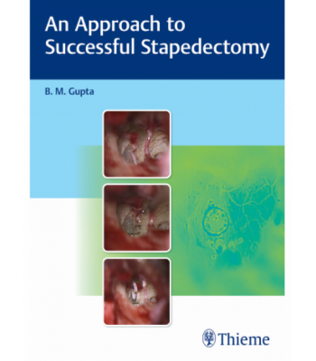 An Approach to Successful Stapedectomy