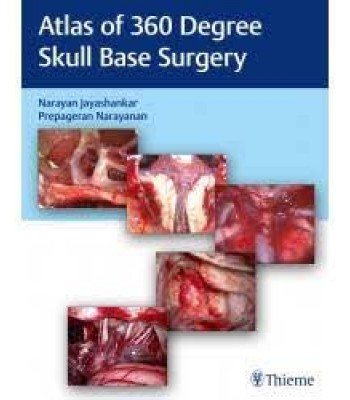 Atlas of 360 Degree Skull Base Surgery 