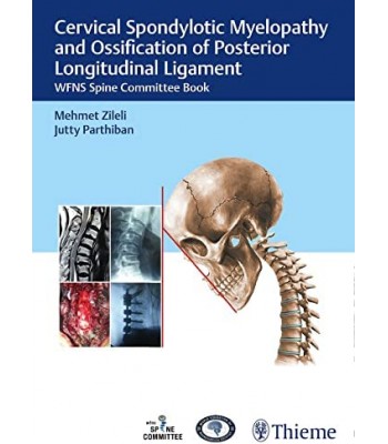  Cervical Spondylotic Myelopathy and Ossification of Posterior Longitudinal Ligament WFNS Spine Committee Book