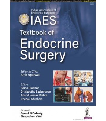 Textbook of Endocrine Surgery